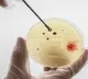 Targeted steroid use shows promise against TB