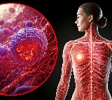 Study warns high-fat keto diet may drive breast cancer risk