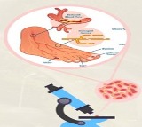Nagaland University researchers find plant compound to treat diabetic wound foot ulcers