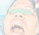 Andhra Pradesh Man Stabs Wife in Face Knife Exits Mouth