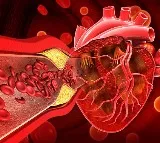 Heart Health Drinks to Prevent Artery Blockage
