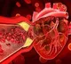 Heart Health Drinks to Prevent Artery Blockage