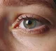 Study shows eye scans may provide clues to ageing, heart disease risk