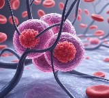 Tiny metal particles show potential in targeting cancer cells: Study