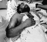 DCP Chaitanya Kumar Attacked by Criminal Omar Ansari