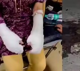 Acid Attack Delhi student attacked with acid in Ashok Vihar