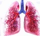 Chest X-rays inadequate to detect asymptomatic TB among household contacts: The Lancet
