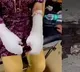 Akil Khan Arrested in Delhi Acid Attack Case Twist