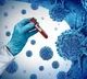 Cancer Early Detection with Blood Test A Key Medical Advancement