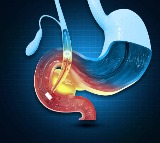 Bloating Relief Foods That Work Wonders