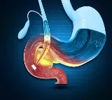Bloating Relief Foods That Work Wonders