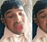 Kanpur Incident Woman Bites Off Ex Lovers Tongue After Assault Attempt