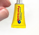 Meerut Doctor uses Fevikwik instead of stitches on childs head