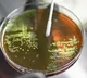 Amoebae from Mumbai creek harbouring bacteria with high AMR risk: IIT Bombay study