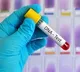 Uganda DNA Tests Cause Family Crisis