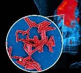 IIT Bombay study shows how TB bacteria shield themselves from antibiotics, stay alive longer