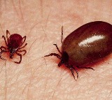 Guntur GGH Two Women Died with Scrub Typhus