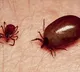 Guntur GGH Two Women Died with Scrub Typhus
