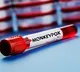 2,501 new confirmed mpox cases, 12 deaths reported from 44 countries in October: WHO