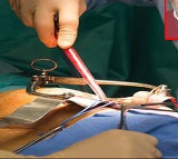 Drunk UP Man and Nephew Operate On Woman After Watching YouTube She Dies