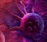 Sperm Donor 200 Children at Risk of Cancer