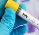 7400 HIV Cases In Bihars Sitamarhi Trigger Alarm