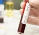 5 Children Get HIV In Madhya Pradesh From Donated Blood