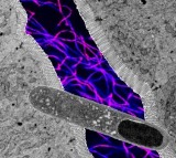 US researchers find gut bacteria that can help lose weight, boost metabolic health