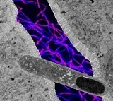 US researchers find gut bacteria that can help lose weight, boost metabolic health