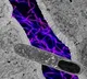 US researchers find gut bacteria that can help lose weight, boost metabolic health