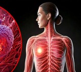 ICMR Study Reveals Breast Cancer Risks in Indian Women