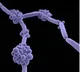 Indian study shows drug-resistant fungus turning more deadly, spreading globally