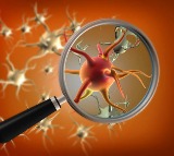 Candida Auris Deadly Drug Resistant Fungus More Fatal Than Before