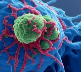 Higher intake of processed foods with preservatives may raise risk of cancer