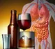 Alcohol Binge Drinking Seriously Damages Gut Health Study Reveals