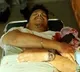 China Manja Injures Techie in Hyderabad