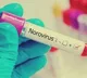 Norovirus infections sicken over 100 students in south China school