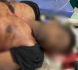 TDP Activist Dies in Clash with YSRCP in Kakinada District