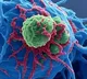 Hyaluronic acid may help improve gynaecological cancer treatment says Study