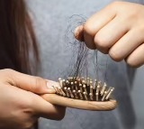 Chinese Woman Divorced Over Baldness Caused By Skin Disease Sparks Debate