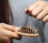 Chinese Woman Divorced Over Baldness Caused By Skin Disease Sparks Debate