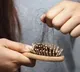 Chinese Woman Divorced Over Baldness Caused By Skin Disease Sparks Debate