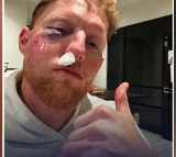 Ben Stokes Suffers Serious Injury After Being Struck By Ball During Training