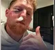 Ben Stokes Suffers Serious Injury After Being Struck By Ball During Training