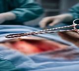 Surgical forceps left in Kerala woman's abdomen removed after five years