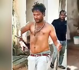 Nellore Man Bitten by Snake Brings it to Hospital