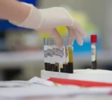 Telangana government offers free cancer screening and medical tests for women