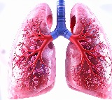 India launches world’s 1st clinical trial to test Ayurveda with TB treatment