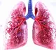 India launches world’s 1st clinical trial to test Ayurveda with TB treatment