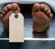 Andhra doctor, wife die in suicide pact after killing their mentally challenged toddler